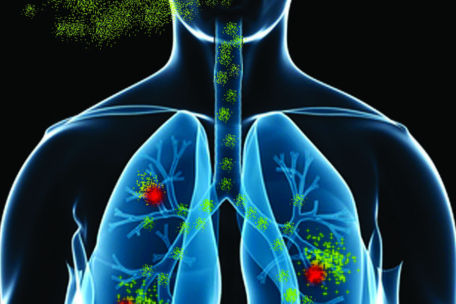 Lung exposure to radon