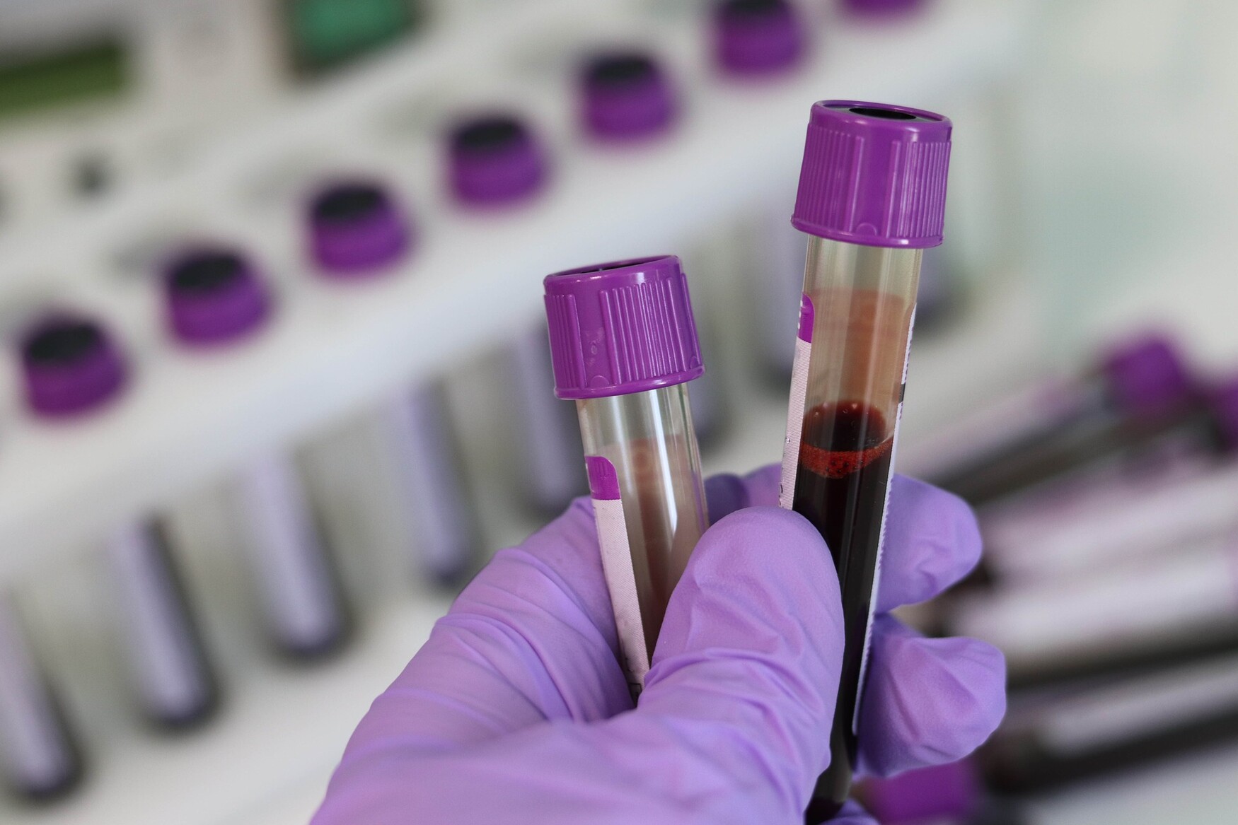 blood test stock image